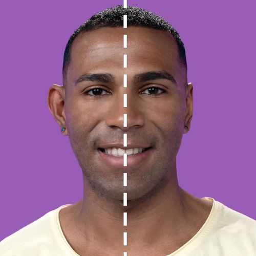 ✅CORRECTOR DE OREJAS EARSTICK